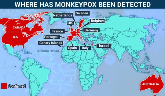 Újabb fejlemények a majomhimlő kapcsán: Nagy-Britanniában duplájára nőtt és ezzel már 20 az azonosított fertőzöttek száma 4