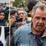 Összecsaptak a rendőrök és a koronavírus ellen tüntetők Londonban