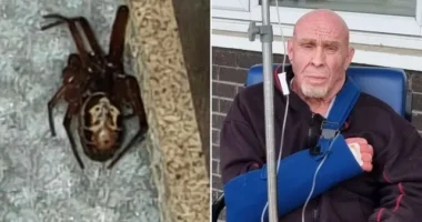 Borzasztó sebet okozott, majdnem amputálni kellett egy férfi kezét Nagy-Britannia egyik legmérgesebb pókjának csípése után