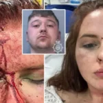 Egy fiatal brit nő arra sem emlékezett, hogy miért csupa zúzódás és miért van hatalmas seb a fején – aztán az ápolónő csak 4 szót mondott neki