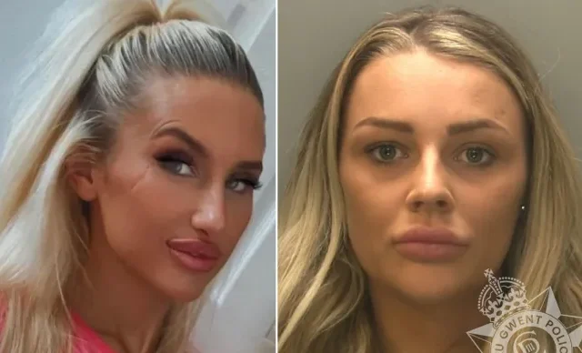 Legjobb barátnője arcát nyitotta fel egy törött üveggel egy nő Nagy-Britanniában, csak mert részegen összevesztek egy kutyán