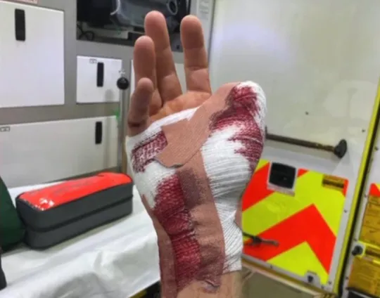 Leharapta egy férfi hüvelykujját a Deliveroo pizzafutára Angliában, mert összevitatkoztak a pizzán 5