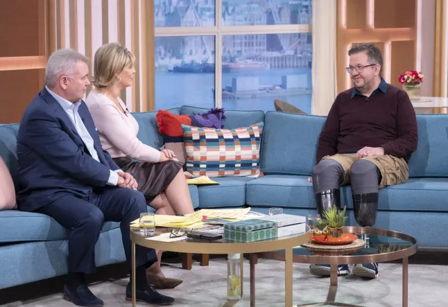 Saját lábait amputáltatta egy orvos Angliában és most csalással vádolják - sötét titok áll a dolgok hátterében