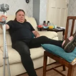 Egy törött lábú férfivel közölték, hogy „alkalmas a munkára” és menjen el dolgozni, miután megpróbált támogatást igényelni Nagy-Britanniában