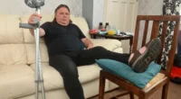 Egy törött lábú férfivel közölték, hogy „alkalmas a munkára” és menjen el dolgozni, miután megpróbált támogatást igényelni Nagy-Britanniában 2