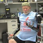A világ legfejlettebb robotvégtagja