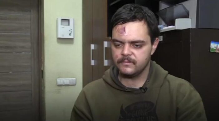 Képeket tettek közzé az oroszok által elfogott, az ukránok oldalán harcoló brit férfiről megbilincselve, sérülésekkel a fején 5