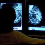 Elmaradt rákszűrések, magukra hagyott betegek – a koronavírus utóhatása Angliában is látszik