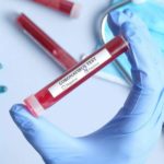 Megvan! Sikerült kifejleszteni az antitestes koronavírus tesztet, amit Európa-szerte engedélyeztek is