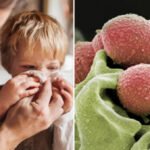 Rövid időn belül már a nyolcadik kisgyerek halt meg Streptococcus A-ban Nagy-Britanniában, és jóval magasabb a súlyos esetek száma