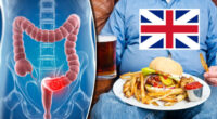 Brit szakértők új listát tettek közzé azokról az élelmiszerekről, amelyek növelik a rák kockázatát 2