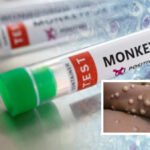 Közel triplájára nőtt a majomhimlővel fertőzöttek száma pár nap alatt Angliában