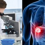 Új szervet fedeztek fel az emberi testben, ami ráadásul segíthet a rák elleni küzdelemben