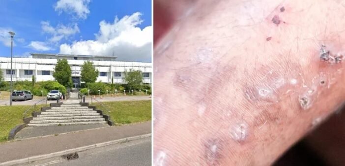 "Középkori" bőrbetegség terjed az angliai iskolákban Devonban – iskolabezárás, aggódó szülők és gyorsan terjedő fertőzés "Középkori" bőrbetegség terjed az angliai iskolákban Devonban – iskolabezárás, aggódó szülők és gyorsan terjedő fertőzés