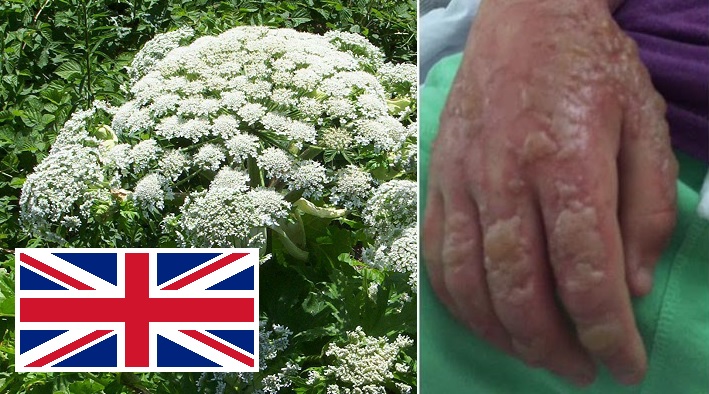 Nagy-Britannia legveszélyesebb növénye gombamód elszaporodott, érdemes figyelni 1