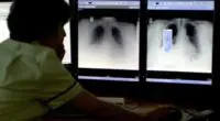 Komoly áttörés a rák ellen folytatott harcban egy Angliában kifejlesztett új tesztnek köszönhetően