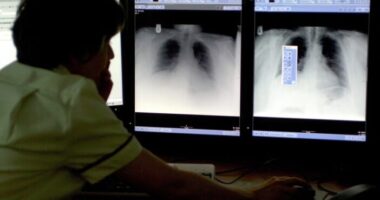 Komoly áttörés a rák ellen folytatott harcban egy Angliában kifejlesztett új tesztnek köszönhetően