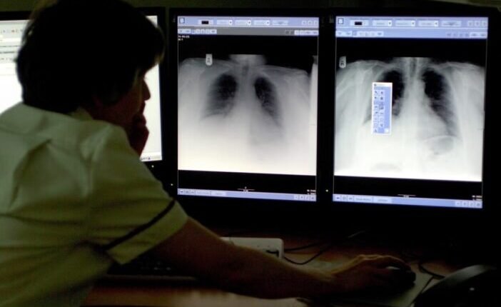 Komoly áttörés a rák ellen folytatott harcban egy Angliában kifejlesztett új tesztnek köszönhetően