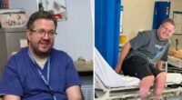 Saját lábait amputáltatta egy orvos Angliában és most csalással vádolják - sötét titok áll a dolgok hátterében