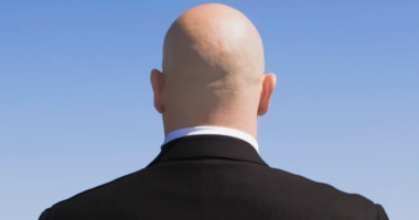 Ha kopasznak neveznek a munkahelyen, az már szexuális diszkriminációnak számít Nagy-Britanniában...